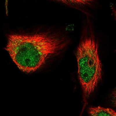 Immunocytochemistry/ Immunofluorescence: Delta 1 Tubulin Antibody [NBP1-87391]