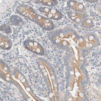 Immunohistochemistry: Delta 1 Tubulin Antibody [NBP1-87391]