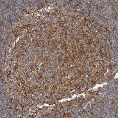 Immunohistochemistry-Paraffin: Delta 1 Tubulin Antibody [NBP1-87390]