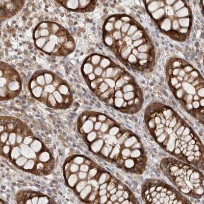 Immunohistochemistry-Paraffin: Delta 1 Tubulin Antibody [NBP1-87390]