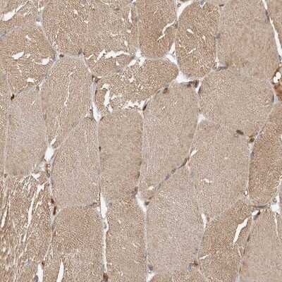 Immunohistochemistry-Paraffin: Delta 1 Tubulin Antibody [NBP1-87390]