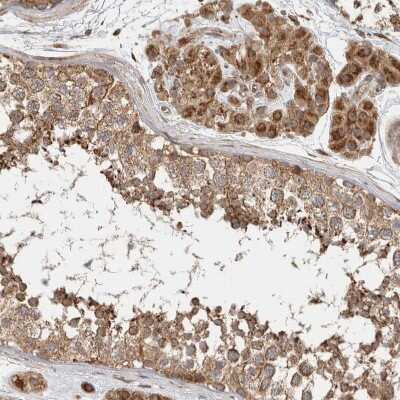 Immunohistochemistry-Paraffin: Delta 1 Tubulin Antibody [NBP1-87390]
