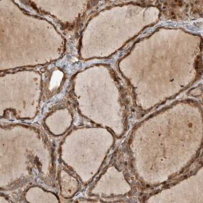 Immunohistochemistry-Paraffin: Delta 1 Tubulin Antibody [NBP1-87390]