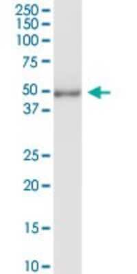 Western Blot: Delta 1 Tubulin Antibody [H00051174-D01P]