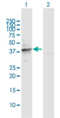 Western Blot: Delta 1 Tubulin Antibody [H00051174-D01P]