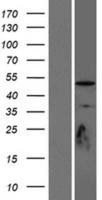 Western Blot: Delta 1 Tubulin Overexpression Lysate [NBP2-07065]