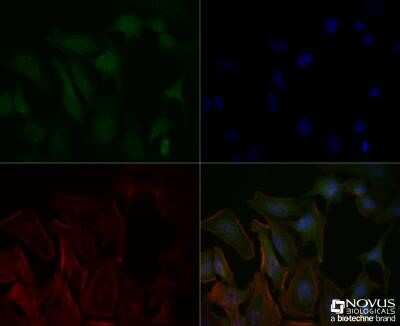 Immunocytochemistry/ Immunofluorescence: Delta Np73 Antibody (38C674.2) - Azide and BSA Free [NBP2-33262]
