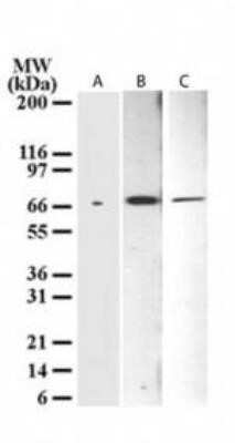 Western Blot: Delta Np73 Antibody (38C674.2)Azide and BSA Free [NBP2-33262]