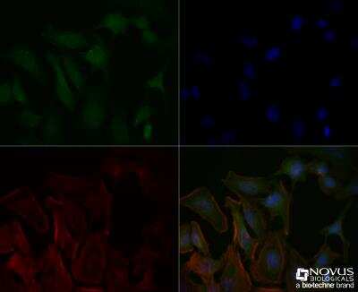 Immunocytochemistry/ Immunofluorescence: Delta Np73 Antibody (38C674.2) [NBP2-24873]