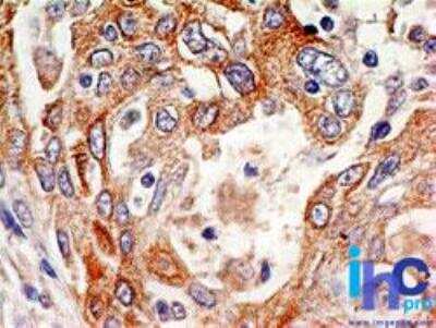 Immunohistochemistry-Paraffin: Delta Np73 Antibody (38C674.2) [NBP2-24873]