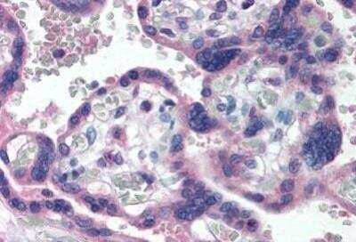Immunohistochemistry-Paraffin: Delta Np73 Antibody (38C674.2) [NBP2-24873]