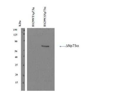 Western Blot: Delta Np73 Antibody (DNp73-1.1)BSA Free [NBP3-11702]