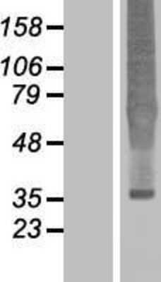 Western Blot: delta Opioid R/OPRD1 Overexpression Lysate [NBL1-13942]