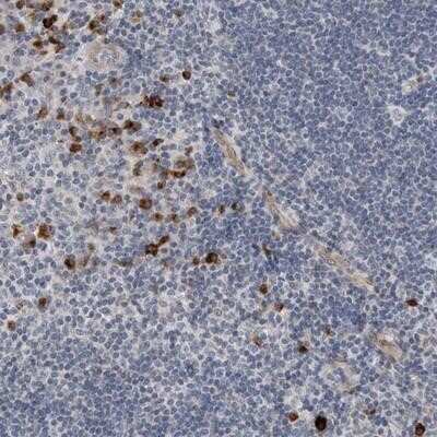 Immunohistochemistry-Paraffin: Dematin Antibody [NBP1-85007]