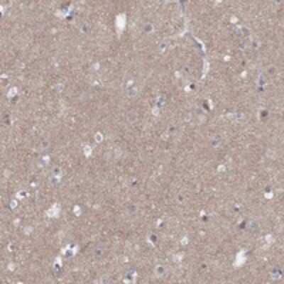 Immunohistochemistry-Paraffin: Dematin Antibody [NBP3-17829]