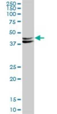 Western Blot: Dematin Antibody [H00002039-B01P]