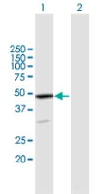 Western Blot: Dematin Antibody [H00002039-B01P]