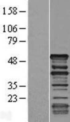 Western Blot: Dematin Overexpression Lysate [NBP2-10790]