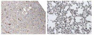 Immunohistochemistry-Paraffin: Dendritic Cell Marker Antibody (AP-MAB0801) - Azide and BSA Free [NB110-85474]