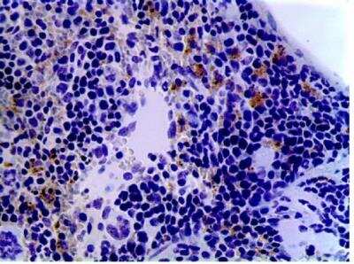 Immunohistochemistry-Paraffin: Dendritic Cell Marker Antibody (AP-MAB0801) - Azide and BSA Free [NB110-85474]