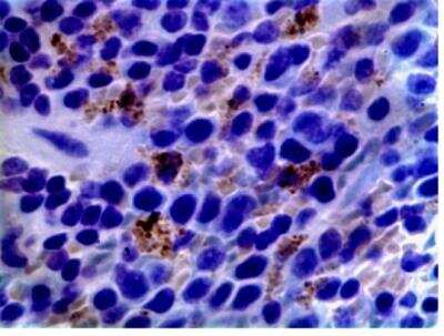 Immunohistochemistry-Paraffin: Dendritic Cell Marker Antibody (AP-MAB0801) - Azide and BSA Free [NB110-85474]