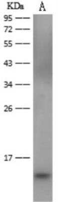 Western Blot: Dengue Virus 2 Envelope Antibody (144)(Domain III) [NBP3-05828]