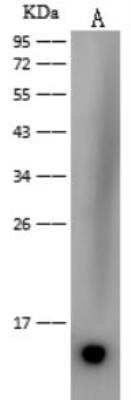 Western Blot: Dengue Virus 2 Envelope Antibody (201)(Domain III) [NBP3-05838]