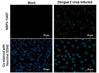 Immunocytochemistry/ Immunofluorescence: Dengue Virus 2 Envelope Antibody (GT214) [NBP3-13487]