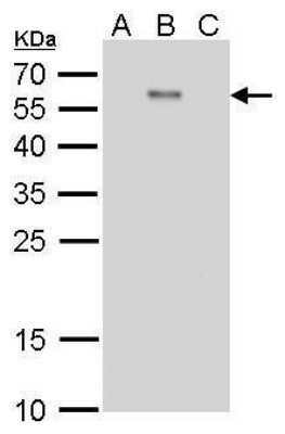 Western Blot: Dengue Virus 2 Envelope Antibody (GT214) [NBP3-13487]