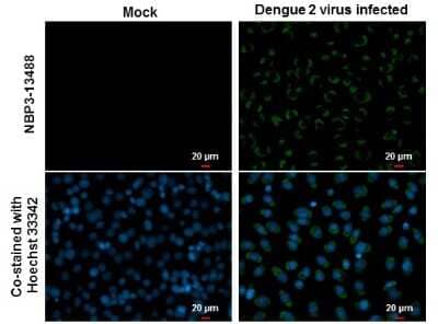 Immunocytochemistry/ Immunofluorescence: Dengue Virus 2 Envelope Antibody (GT643) [NBP3-13488]