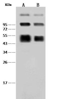 Western Blot: Dengue Virus NS1 protein Antibody [NBP3-06439]