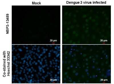Immunocytochemistry/ Immunofluorescence: Dengue Virus NS5 Antibody (GT353) [NBP3-13489]