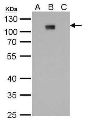 Western Blot: Dengue Virus NS5 Antibody (GT353) [NBP3-13489]