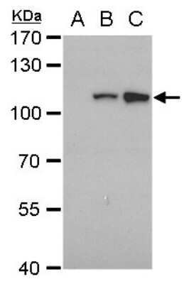 Western Blot: Dengue Virus NS5 Antibody (GT353) [NBP3-13489]