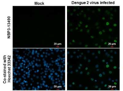 Immunocytochemistry/ Immunofluorescence: Dengue Virus NS5 Antibody (GT361) [NBP3-13490]