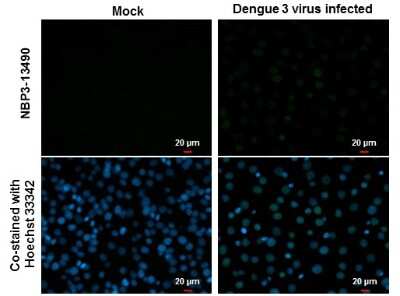 Immunocytochemistry/ Immunofluorescence: Dengue Virus NS5 Antibody (GT361) [NBP3-13490]