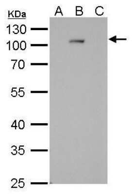 Western Blot: Dengue Virus NS5 Antibody (GT361) [NBP3-13490]