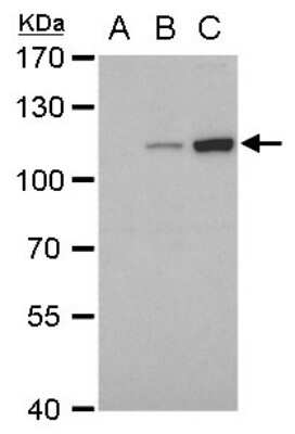 Western Blot: Dengue Virus NS5 Antibody (GT361) [NBP3-13490]