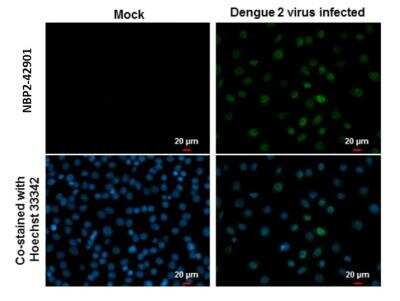 Immunocytochemistry/ Immunofluorescence: Dengue Virus NS5 Antibody [NBP2-42901]
