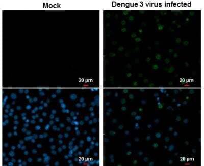 Immunocytochemistry/ Immunofluorescence: Dengue Virus NS5 Antibody [NBP2-42901]