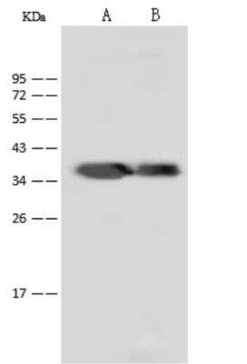Western Blot: Dengue Virus NS5 Antibody(methyltransferase domain) [NBP3-06447]