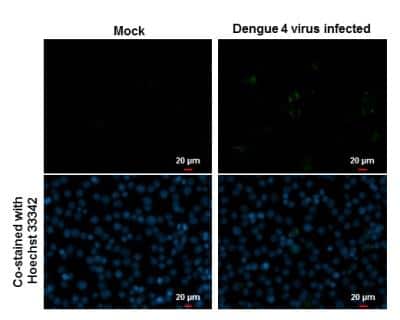 Immunocytochemistry/ Immunofluorescence: Dengue Virus NS1 protein Antibody [NBP2-54602]