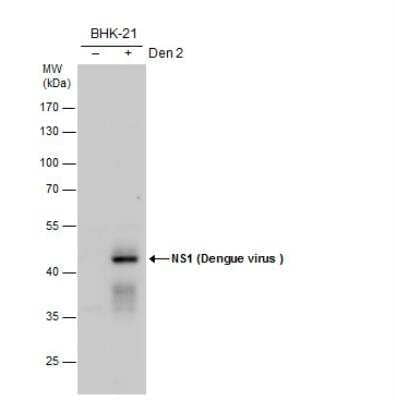 Western Blot: Dengue Virus NS1 protein Antibody [NBP2-54602]