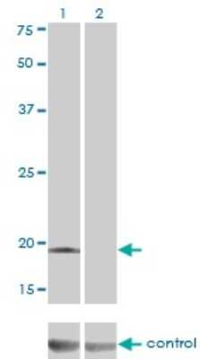 Western Blot: Deoxycytidylate deaminase Antibody (4B9) [H00001635-M01]