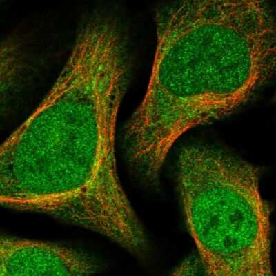 Immunocytochemistry/ Immunofluorescence: Deoxycytidylate deaminase Antibody [NBP1-87424]