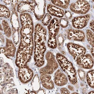 Immunohistochemistry-Paraffin: Deoxycytidylate deaminase Antibody [NBP1-87424]