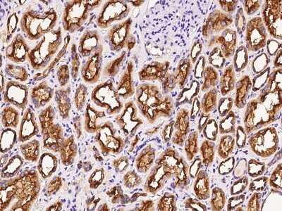 Immunohistochemistry-Paraffin: Deoxycytidylate deaminase Antibody [NBP2-99193]