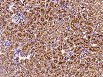 Immunohistochemistry-Paraffin: Deoxycytidylate deaminase Antibody [NBP2-99193]