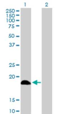 Western Blot: Deoxycytidylate deaminase Antibody [H00001635-D01P]