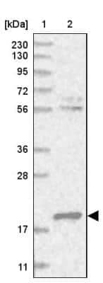 Western Blot: Deoxycytidylate deaminase Antibody [NBP1-87424]